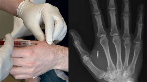 first mention of rfid chips|rfid chips in humans.